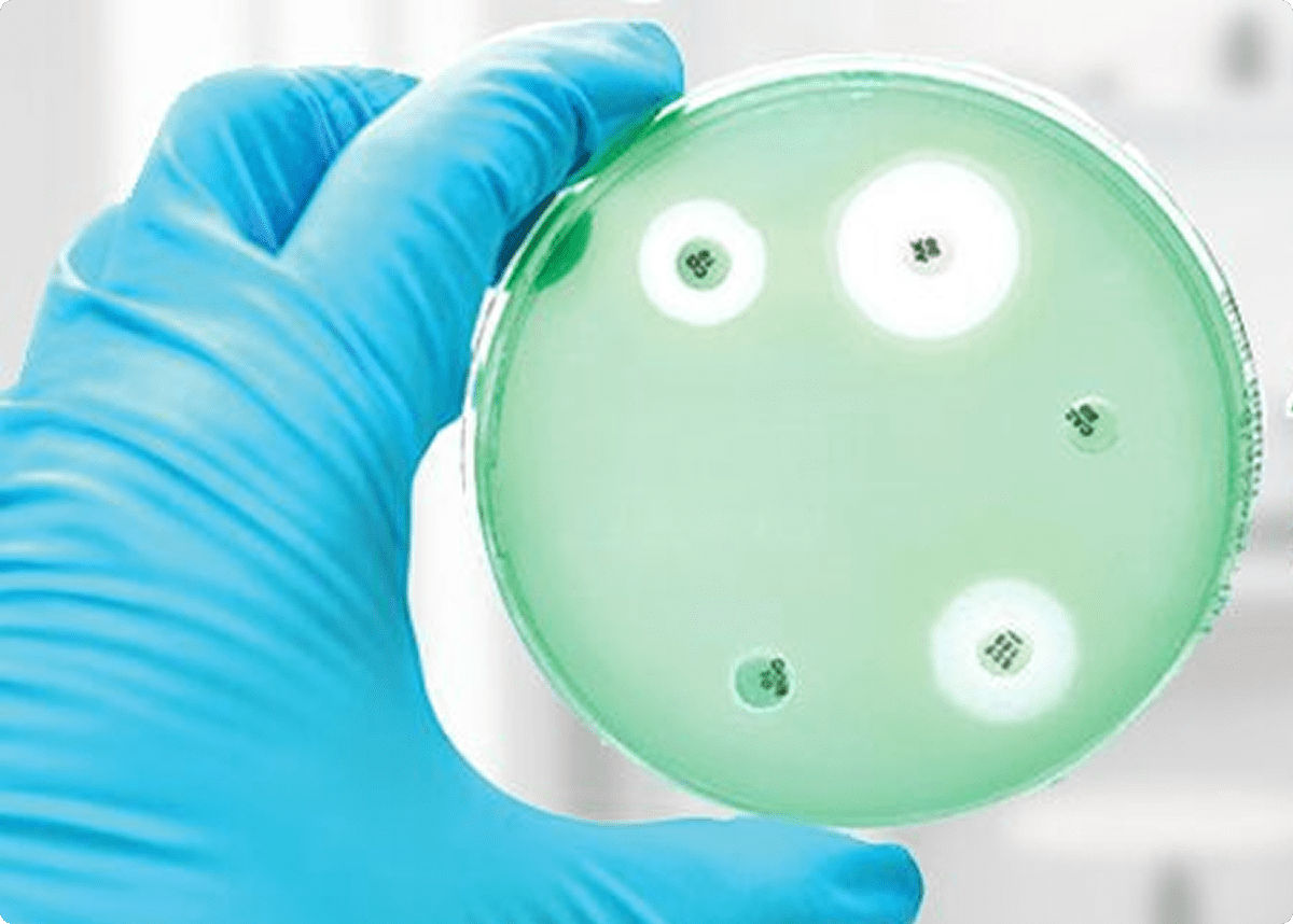 Gloved hand holding bacterial culture dish