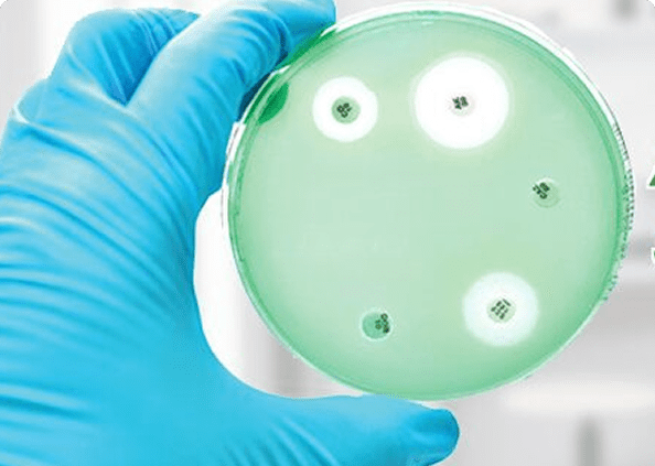 Gloved hand holding a petri dish